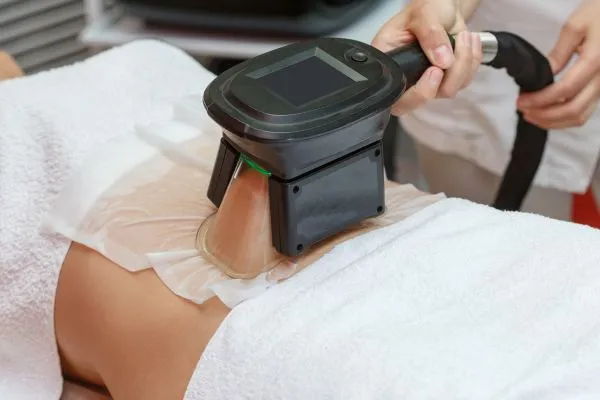 Image of person having fat freezing treatment to help weight gain Huntingdon