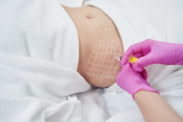 image of fat dissolving injections on love handles to help combat weight gain Huntingdon