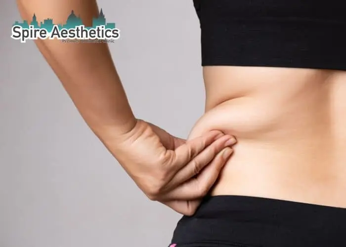 Image of woman pinching fat on their hips Huntingdon. Fat Freezing treatment