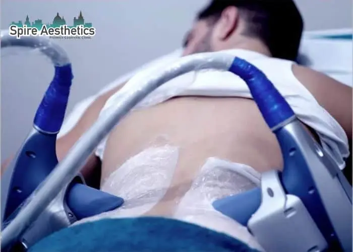 Man having fat freezing treatment done on love handles before a competitions Huntingdon to create a sculpted look.