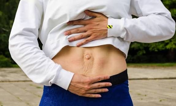 When Could Diastasis Recti Be the Missing Piece of the Puzzle Huntingdon?